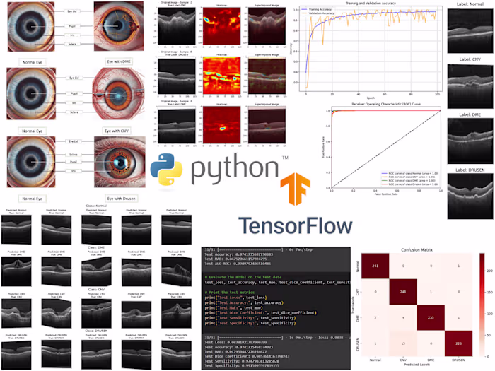 Explainable DL Models for Automated Ophthalmic Diagnosis 