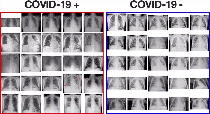 AI-Powered COVID-19 Detection via Chest X-Rays