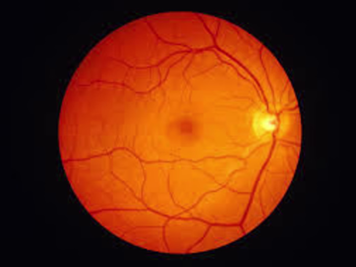 Segmentation of Retinal Images using Transformer-based models