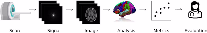 How Machine Learning is Powering Neuroimaging to Improve Brain …