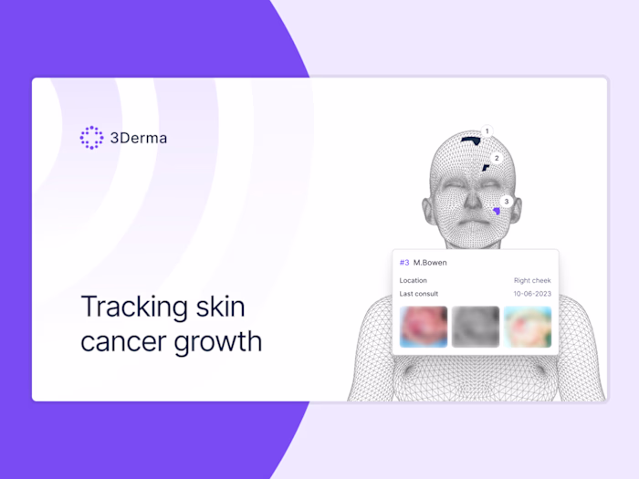 Analyze skin lesions to help detect early signs of skin cancer