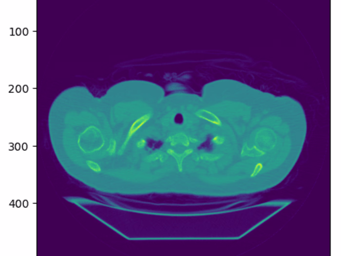 Biomedical Image Analysis