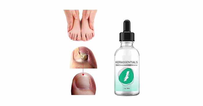 Kerassentials [I've Tested] TRUTH EXPOSED!