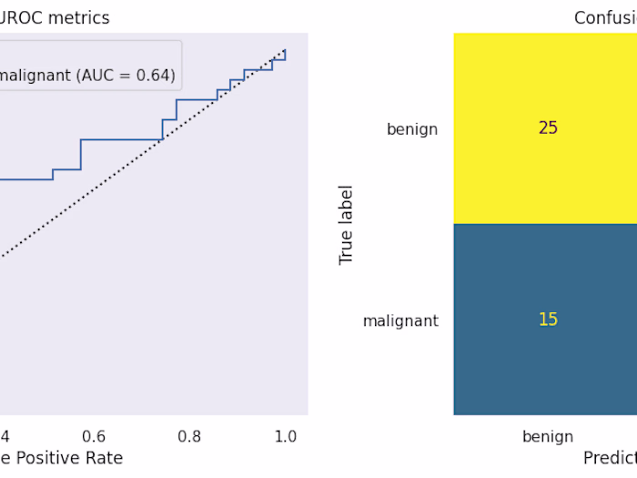 Enhanced and Full Supervision in Breast Cancer Detection