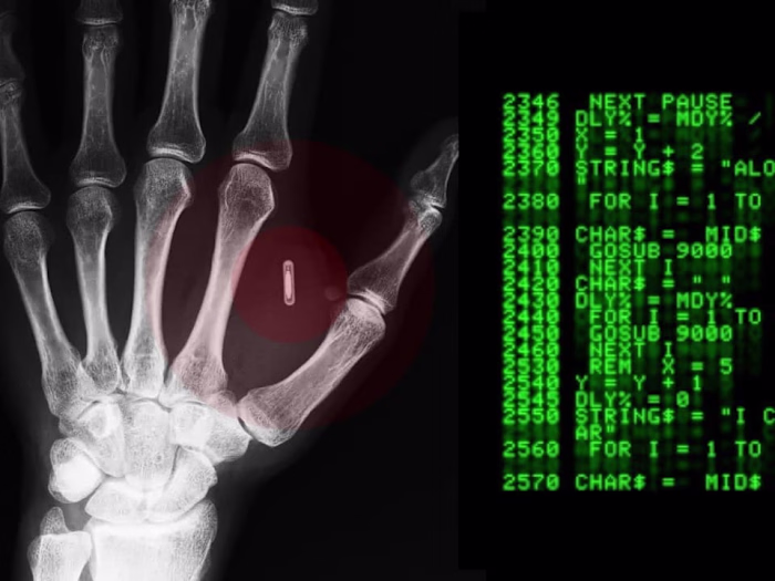 Microchipping Employees is a No-good, Horrible and Terrible Idea