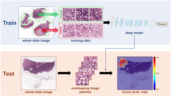 Breast cancer diagnosis using machine learning