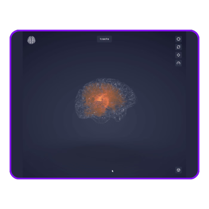 3D Brain Animations | Web app
