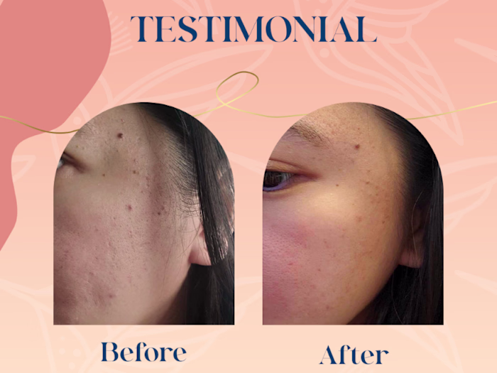 Results-Driven Designs & Landing Page Optimization