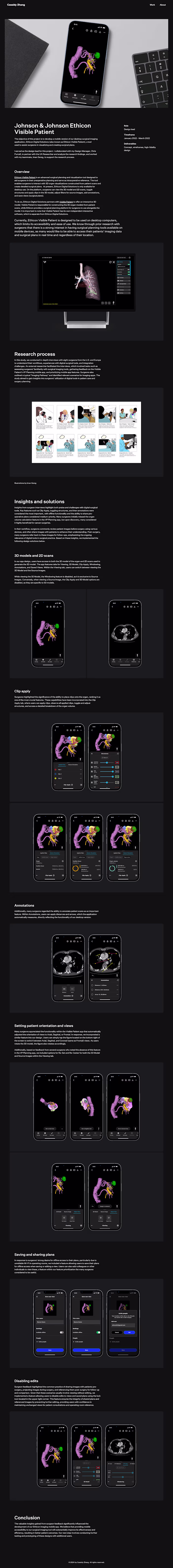 Johnson & Johnson Ethicon Visible Patient