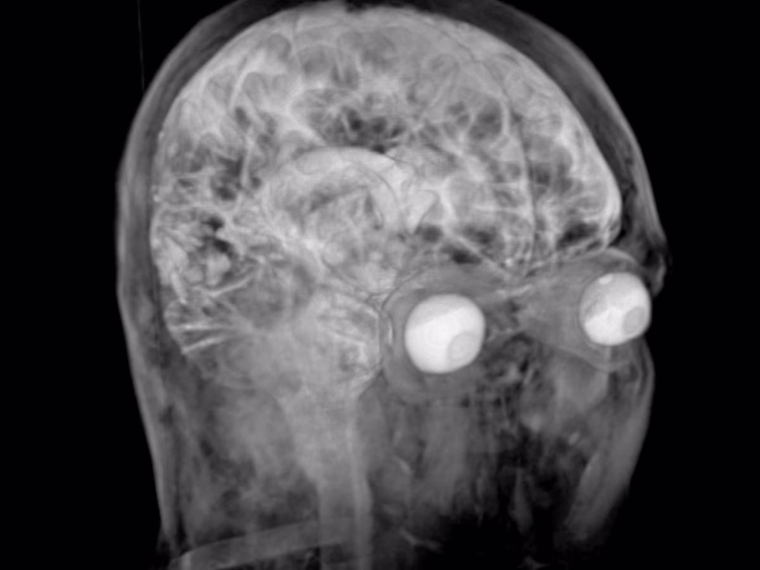 3D Medical Visualisation