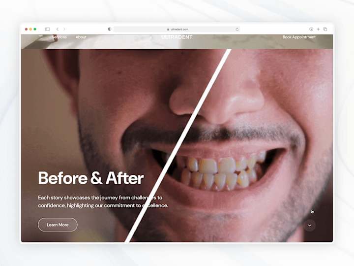 Cover image for UltraDent ◦ Dental Clinic Website