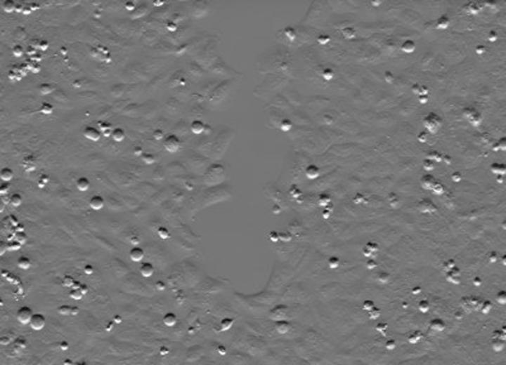 Cover image for Image Processing and Analysis of the Scratch Assay