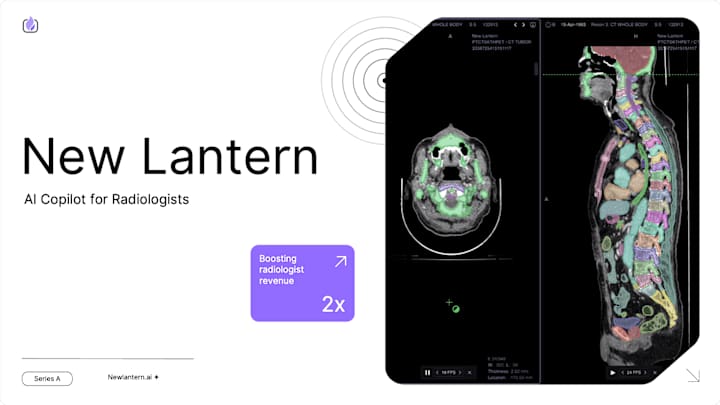 Cover image for AI Copilot for Radiologist_Series A