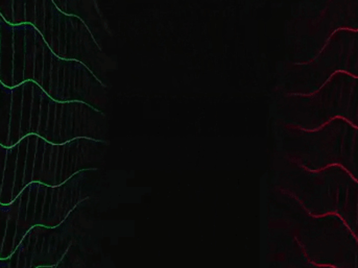 Cover image for 😫ADDICTION ISN'T DOPE- MOTION VIDEO