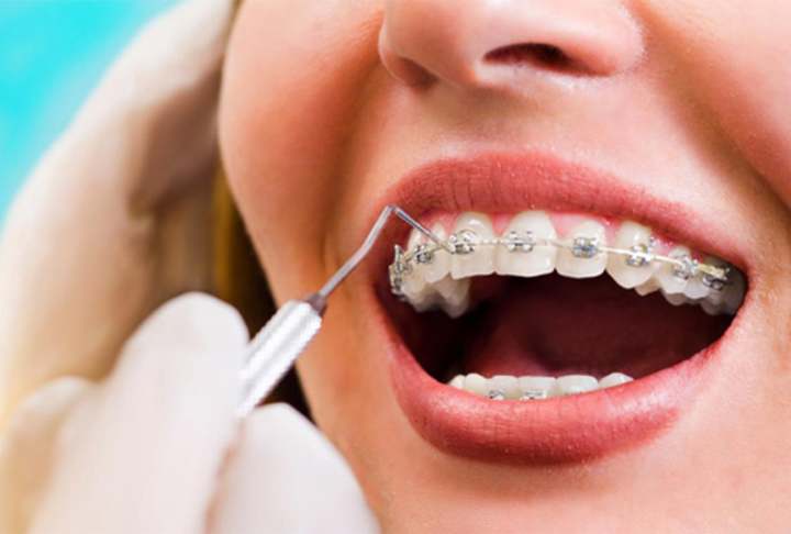 Cover image for SEO Blog Writing for Orthodontist