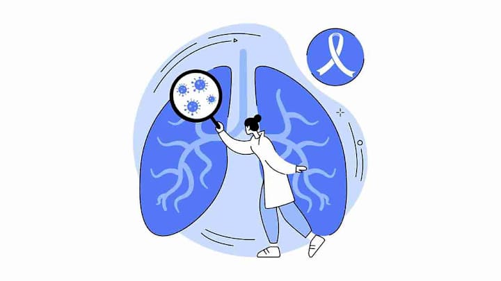 Cover image for CyPath Lung test: A promising tool for early diagnosis of lung …