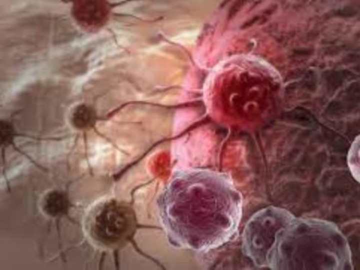 Cover image for Major types of Cancer, Symptoms and Prevention 