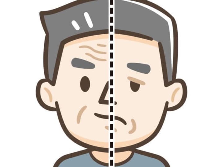Cover image for Stroke signs and symptoms - MosiPhysio