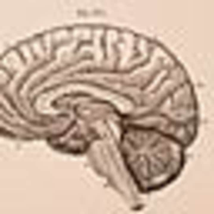Cover image for The Brain of AI vs. Human: Intelligence Insights