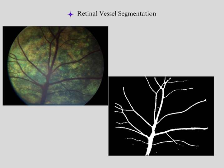 Cover image for Retinal Vessel Identification and Disease Detection