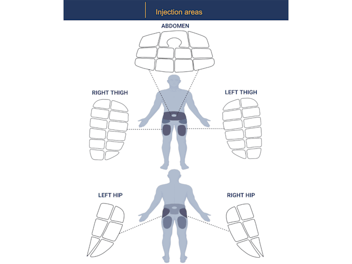 Cover image for An illustration of injection areas