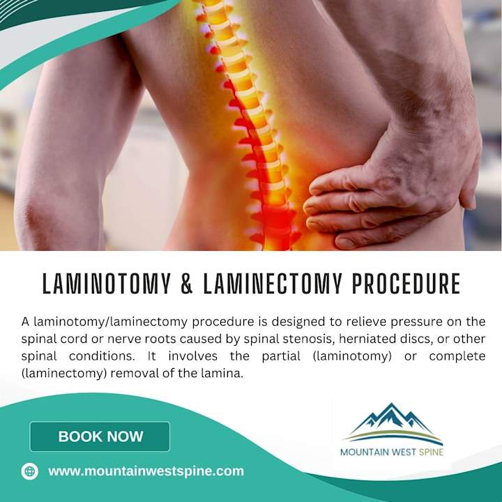 Cover image for Laminotomy/Laminectomy Surgical Solutions at Mountain West Spine