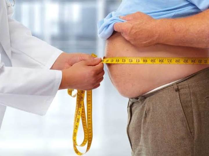 Cover image for LIFE IN OBESITY 