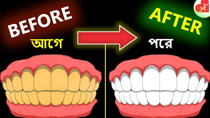 Cover image for Make Yellow Teeth Sparkle Pearly White at Home (Easy)