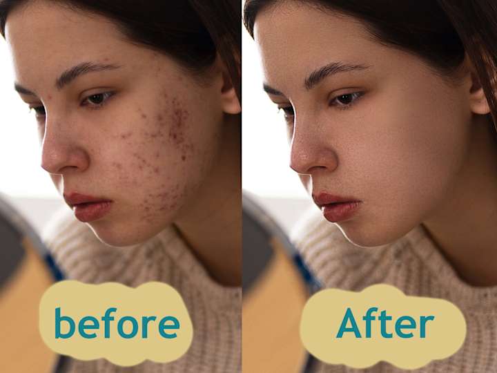 Cover image for photo edit, Retouching & Enhancement, background/object removal.