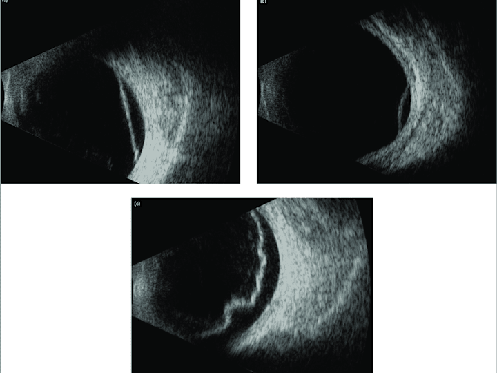 Cover image for Medical Application Development Using Qt/QML and C++