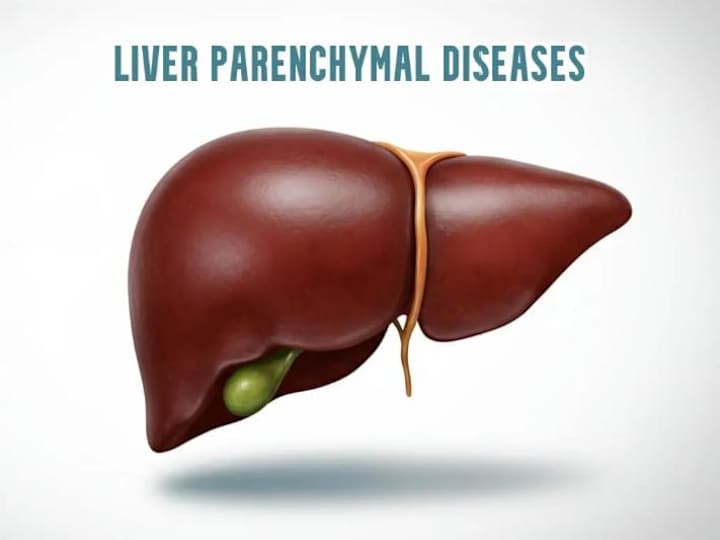 Cover image for Comprehensive Guide on Hepatic Parenchymal Disease