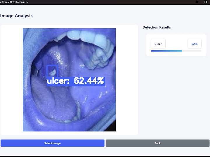 Cover image for AI-Powered Oral Disease Detection System