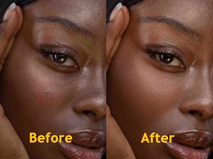 Cover image for blemishes removal and high-end skin retouching & enhancments