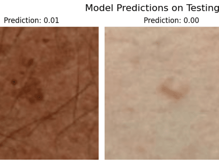 Cover image for Skin Lesion Detection Using Convolutional Neural Networks – ISI…