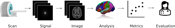 Cover image for How Machine Learning is Powering Neuroimaging to Improve Brain …