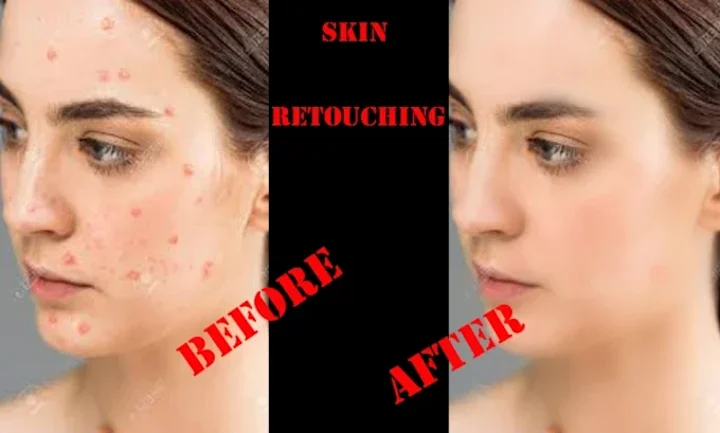 Cover image for I will do high end photo retouching, skin retouching