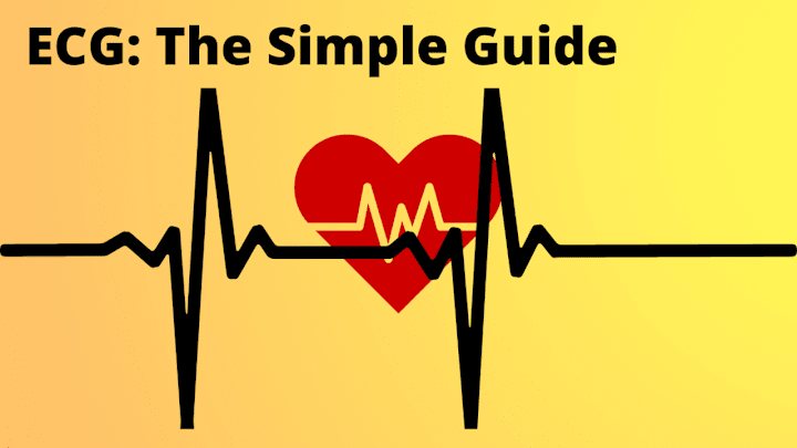 Cover image for What is an ECG: The Simple Guide