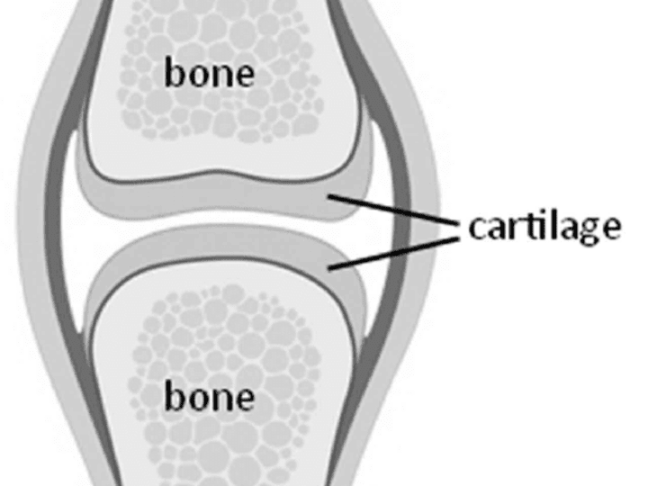 Cover image for CARTILAGE - MosiPhysio
