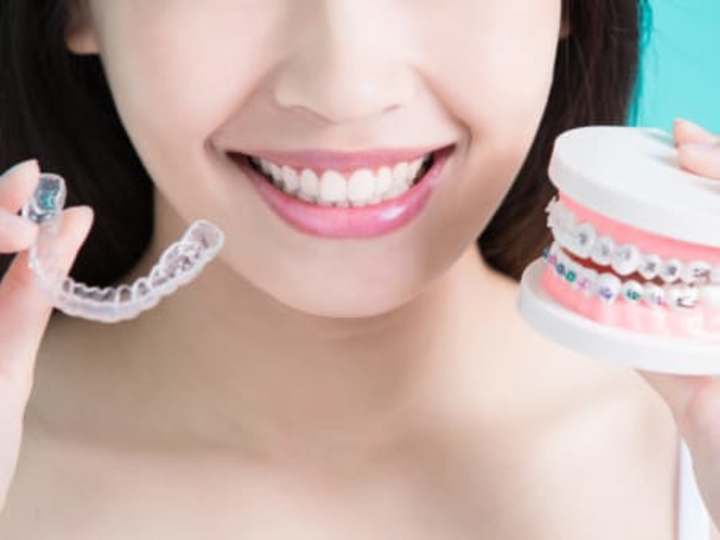 Cover image for What You Need to Worry About When You Have Braces