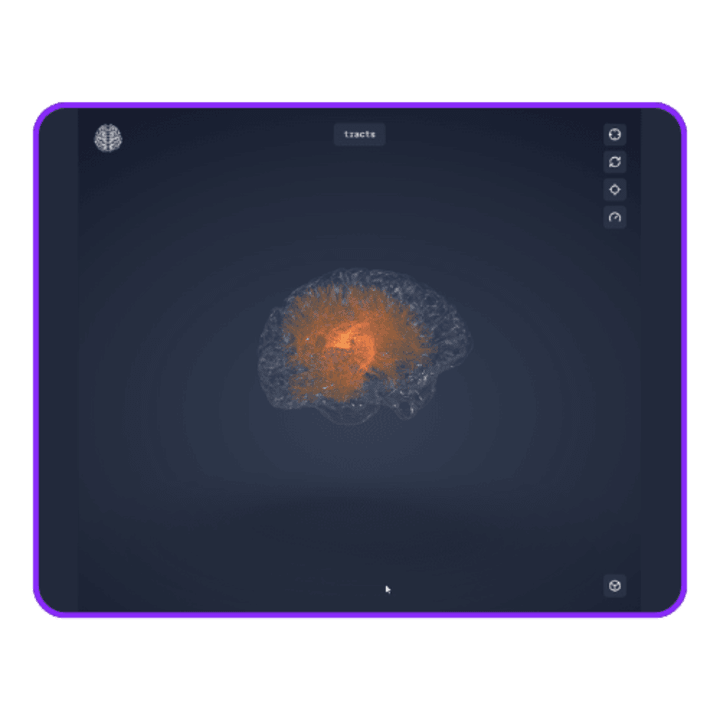 Cover image for 3D Brain Animations | Web app
