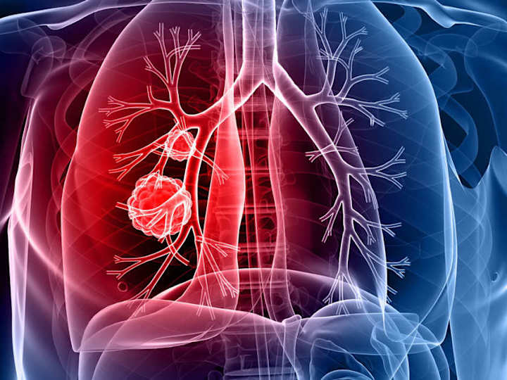 Cover image for samrat0033/Lung_Cancer_Prediction
