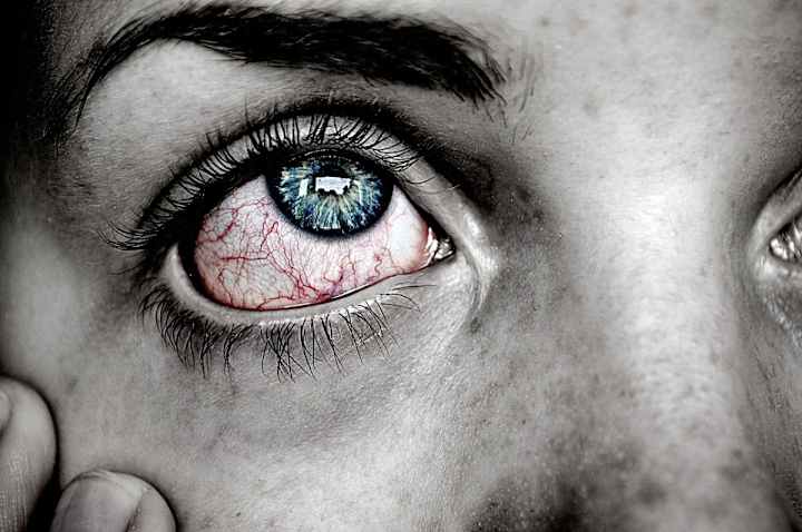 Cover image for How to Cope With Conjunctivitis (Apollo)