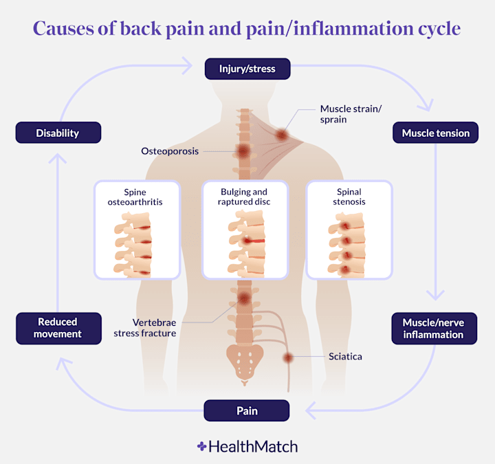 Cover image for Writing and Researching: When Painkillers Make Back Pain Worse