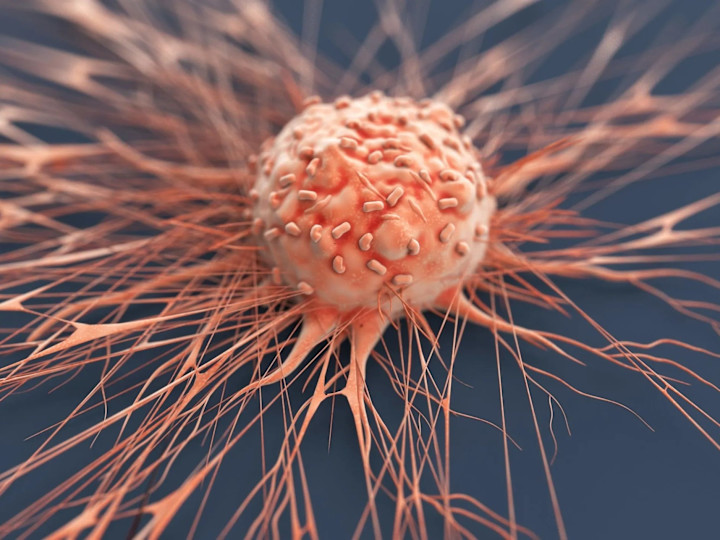 Cover image for "Cancer is a word, not a sentence."