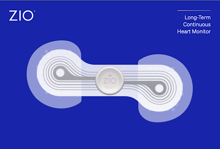 Cover image for Revolutionizing Packaging Design for iRhythm