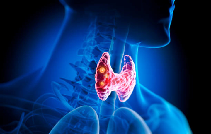 Cover image for Navigating Thyroid Health: Understanding, Managing, and Thriving