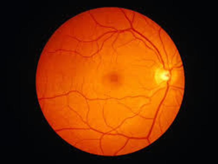 Cover image for Segmentation of Retinal Images using Transformer-based models