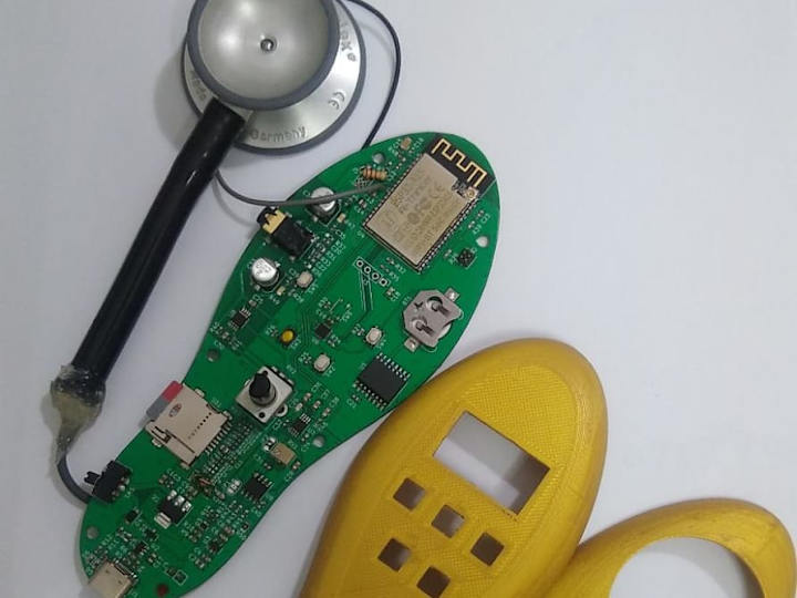 Cover image for Low-cost device to capture lung sounds Device