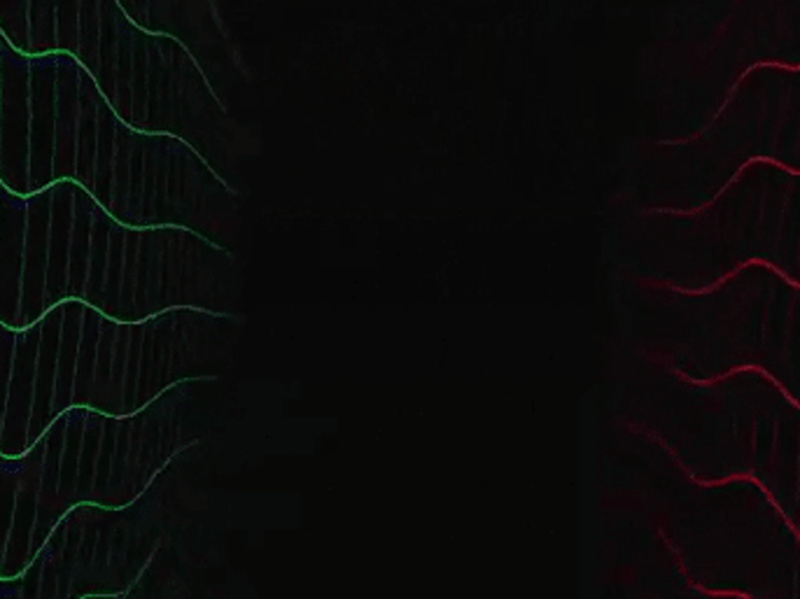 Cover image for 😫ADDICTION ISN'T DOPE- MOTION VIDEO