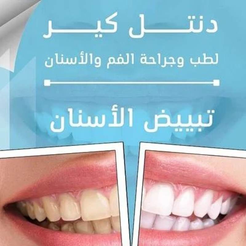Cover image for Husam Mohammed on Instagram‎: ”#تصميمي @dentalcare152″‎